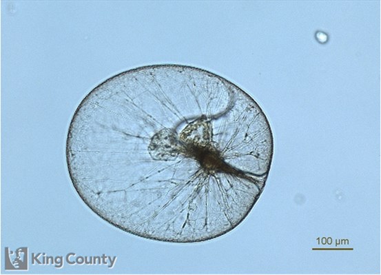 Photo of Noctiluca scintillans
